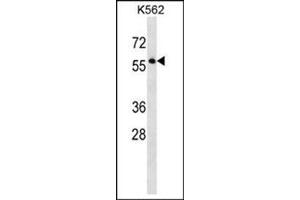 Western blot analysis of SEPT8 Antibody (C-term) Cat.