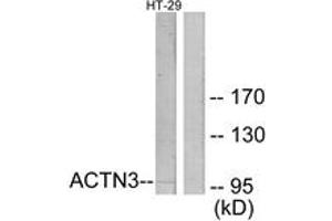 Western blot analysis of extracts from HT-29 cells, using ACTN3 Antibody. (ACTN3 Antikörper  (AA 1-50))
