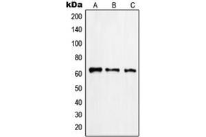 Western blot analysis of Rabaptin 5 beta expression in Jurkat (A), HuvEc (B), human pancreas (C) whole cell lysates.