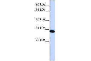 PHF19 antibody used at 0. (PHF19 Antikörper  (C-Term))