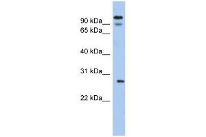 VDAC3 antibody used at 1 ug/ml to detect target protein. (VDAC3 Antikörper  (N-Term))