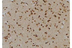 ABIN6264489 and ABIN6277006 at 1/100 staining Human brain tissue by IHC-P.