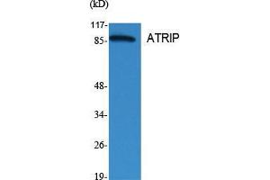 Western Blot (WB) analysis of specific cells using ATRIP Polyclonal Antibody.