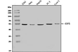 Western blot analysis of EIF5 using anti-EIF5 antibody (ABIN7599722).