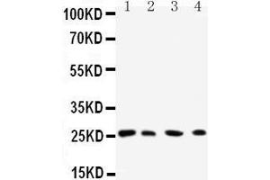 Western Blotting (WB) image for anti-RAB3C, Member RAS Oncogene Family (Rab3c) (AA 204-217), (C-Term) antibody (ABIN3042555) (Rab3c Antikörper  (C-Term))