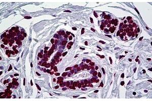 Human Breast: Formalin-Fixed, Paraffin-Embedded (FFPE) (EN1 Antikörper  (AA 266-392))