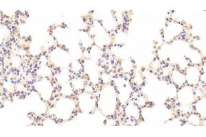 Detection of GAS6 in Mouse Lung Tissue using Polyclonal Antibody to Growth Arrest Specific Protein 6 (GAS6) (GAS6 Antikörper  (AA 483-646))