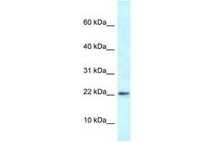 Image no. 1 for anti-RNA Binding Motif Protein 3 (RBM3) (AA 23-72) antibody (ABIN6747435) (RBM3 Antikörper  (AA 23-72))