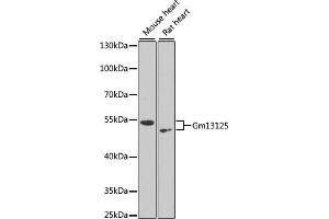Western blot analysis of extracts of various cell lines, using Gm13125 antibody (ABIN6127294, ABIN6141172, ABIN6141175 and ABIN6216319) at 1:1000 dilution. (Pramel15 Antikörper  (AA 1-477))