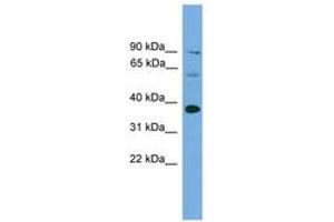 Image no. 1 for anti-Interferon Regulatory Factor 1 (IRF1) (AA 201-250) antibody (ABIN6744535) (IRF1 Antikörper  (AA 201-250))