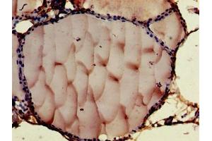 Immunohistochemistry of paraffin-embedded human thyroid tissue using ABIN7148476 at dilution of 1:100 (Contactin 6 Antikörper  (AA 706-812))