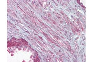 Immunohistochemistry (IHC) image for anti-Potassium Large Conductance Calcium-Activated Channel, Subfamily M, alpha Member 1 (KCNMA1) (AA 1080-1129) antibody (ABIN6748500)