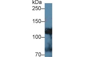 Western Blotting (WB) image for anti-Adducin 1 (Alpha) (ADD1) (AA 388-560) antibody (ABIN7444757)