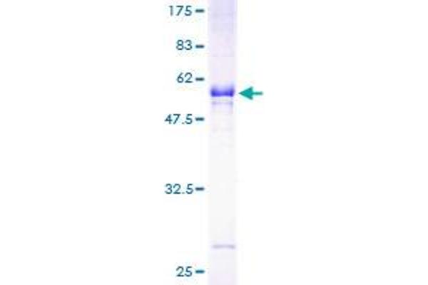 SULT1A1 Protein (AA 1-295) (GST tag)