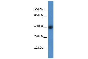 Western Blot showing AGPAT3 antibody used at a concentration of 1 ug/ml against Fetal Liver Lysate (AGPAT3 Antikörper  (Middle Region))