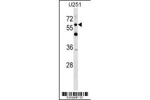Western blot analysis in U251 cell line lysates (35ug/lane). (CSPG5 Antikörper  (C-Term))