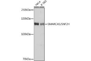 Western blot analysis of extracts of various cell lines, using SM/SM/SNF2H Rabbit mAb (ABIN7270656) at 1:1000 dilution. (SMARCA5 Antikörper)