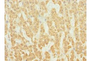 Immunohistochemistry of paraffin-embedded human adrenal gland tissue using ABIN7167252 at dilution of 1:100 (RAB23 Antikörper  (AA 1-237))