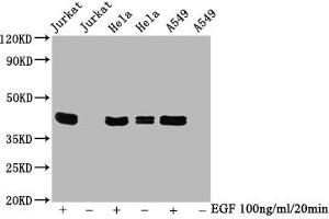 Western Blot Positive WB detected in Jurkat whole cell lysate 72ela whole cell lysate 65549 whole cell lysate(treated with EGF or not) All lanes Phospho-MAPK3 antibody at 0. (Rekombinanter ERK1 Antikörper  (pThr183, pThr202, pThr204, pTyr187))