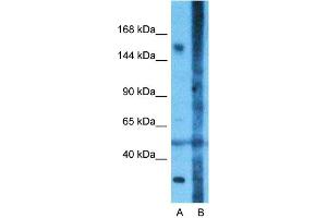 Host:  Rabbit  Target Name:  CNTNAP1  Sample Type:  Fetal Lung  Lane A:  Primary Antibody  Lane B:  Primary Antibody + Blocking Peptide  Primary Antibody Concentration:  1ug/ml  Peptide Concentration:  5ug/ml  Lysate Quantity:  25ug/lane/Lane  Gel Concentration:  0. (CNTNAP1 Antikörper  (N-Term))