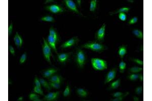 Immunofluorescence staining of Hela Cells with ABIN7127792 at 1:50, counter-stained with DAPI. (Rekombinanter RHEB Antikörper)