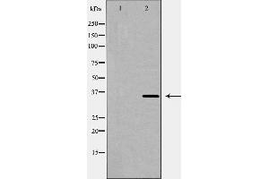 Western blot analysis of HO 2 expression in K562 cell lysate,The lane on the left is treated with the antigen-specific peptide.