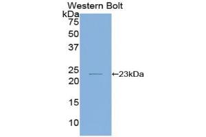 Western blot analysis of the recombinant protein. (IL-1 beta Antikörper  (AA 63-247))
