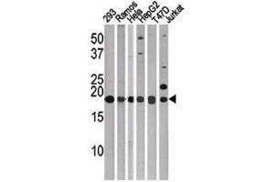Western blot testing of LC3C antibody. (LC3C Antikörper  (AA 1-30))