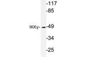 Western blot analysis of IKKγ antibody in extracts from 293 HepG2 cells. (IKBKG Antikörper)
