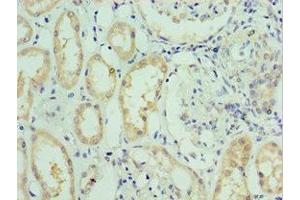 Immunohistochemistry of paraffin-embedded human kidney tissue using ABIN7176713 at dilution of 1:100 (SLC39A6 Antikörper  (AA 170-320))