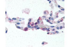 Anti-EMR2 antibody IHC of human lung, neutrophils. (EMR2 Antikörper  (N-Term))