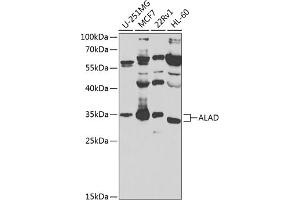Western blot analysis of extracts of various cell lines, using ALAD antibody (ABIN6129892, ABIN6136750, ABIN6136752 and ABIN6224446) at 1:1000 dilution. (ALAD Antikörper  (AA 1-330))