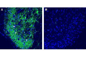Comparison of immunostaining with P2RY1 compared to immunostaining with isotype control in rat spinal cordA.