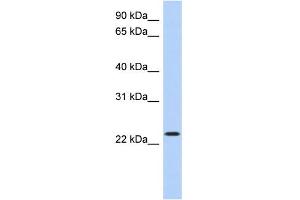 WB Suggested Anti-ATF3 Antibody Titration:  0. (ATF3 Antikörper  (Middle Region))