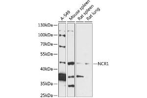 Western blot analysis of extracts of various cell lines, using NCR1 antibody (ABIN7268833) at 1:3000 dilution. (NCR1 Antikörper  (AA 151-303))