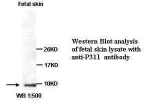 Image no. 1 for anti-Chromosome 5 Open Reading Frame 13 (C5orf13) (C-Term) antibody (ABIN791087) (NREP Antikörper  (C-Term))