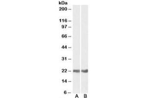 Western blot testing of mouse [A] and rat [B] eye lysates with CRYAB antibody at 0. (CRYAB Antikörper)