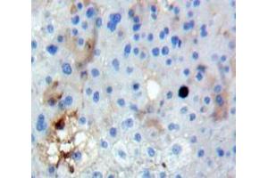 Used in DAB staining on fromalin fixed paraffin-embedded Liver tissue (FUT3 Antikörper  (AA 30-259))