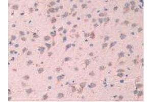 IHC-P analysis of Mouse Brain Tissue, with DAB staining. (TPP1 Antikörper  (AA 198-562))
