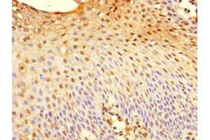 Immunohistochemistry of paraffin-embedded human tonsil tissue using ABIN7173626 at dilution of 1:100 (TSC22D3 Antikörper  (AA 58-134))