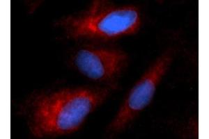 Immunofluorescence (IF) image for anti-Keratin 8 (KRT8) (AA 1-483) antibody (PE) (ABIN5567068) (KRT8 Antikörper  (AA 1-483) (PE))
