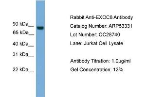 WB Suggested Anti-EXOC8  Antibody Titration: 0. (EXOC8 Antikörper  (N-Term))