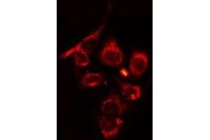 ABIN6275689 staining HT29 cells by IF/ICC. (ZFYVE19 Antikörper  (Internal Region))