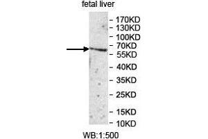 Western blot analysis of fetal liver lysate, using UGT1A1 antibody.