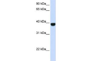WB Suggested Anti-FOXE1 Antibody Titration: 0.