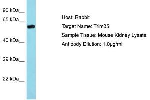 Host: Rabbit Target Name: Trim35 Sample Type: Mouse Kidney lysates Antibody Dilution: 1. (TRIM35 Antikörper  (Middle Region))