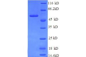 SDS-PAGE (SDS) image for Ubiquitin Specific Peptidase 14 (USP14) (AA 1-494), (full length) protein (His tag) (ABIN5710602) (USP14 Protein (AA 1-494, full length) (His tag))