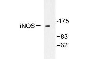 Image no. 1 for anti-Nitric Oxide Synthase 2, Inducible (NOS2) antibody (ABIN265479) (NOS2 Antikörper)
