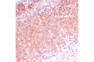 Immunohistochemistry of paraffin-embedded mouse adrenal gland using CYP11B2 antibody (ABIN1679468, ABIN3015492, ABIN3015493 and ABIN6218533) at dilution of 1:100 (40x lens). (CYP11B2 Antikörper  (AA 234-503))