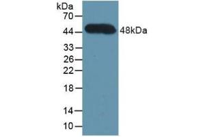 Detection of Recombinant CFH, Human using Polyclonal Antibody to Complement Factor H (CFH)